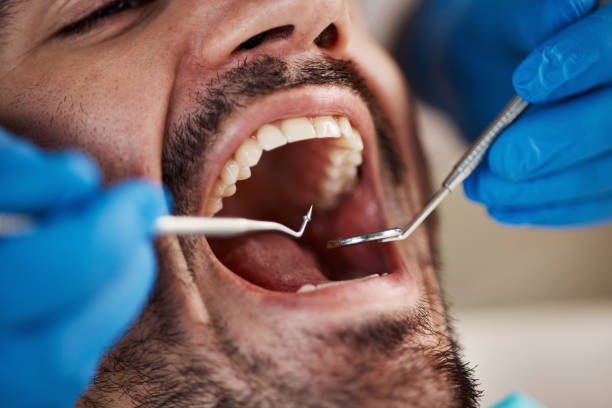 Best Dentist for Severe Toothache  in Snyderville, UT